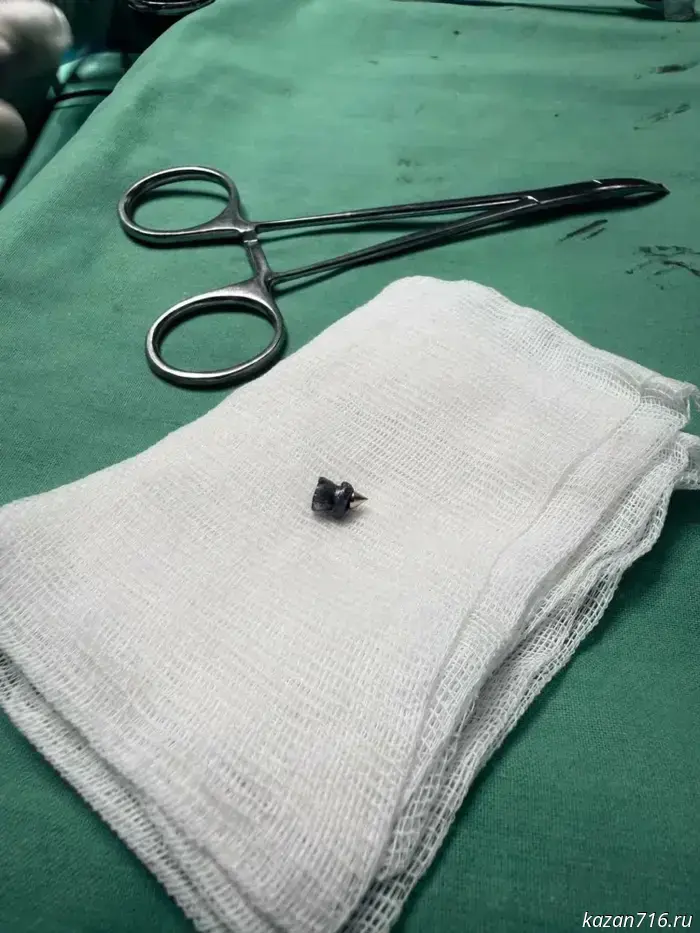 Врачи РКБ извлекли пулю из шеи мужчины.