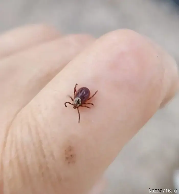 Ticks have appeared in the forests and parks of Leninogorsk.