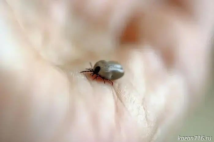 In Tatarstan, the number of people affected by tick bites has exceeded 12,000.