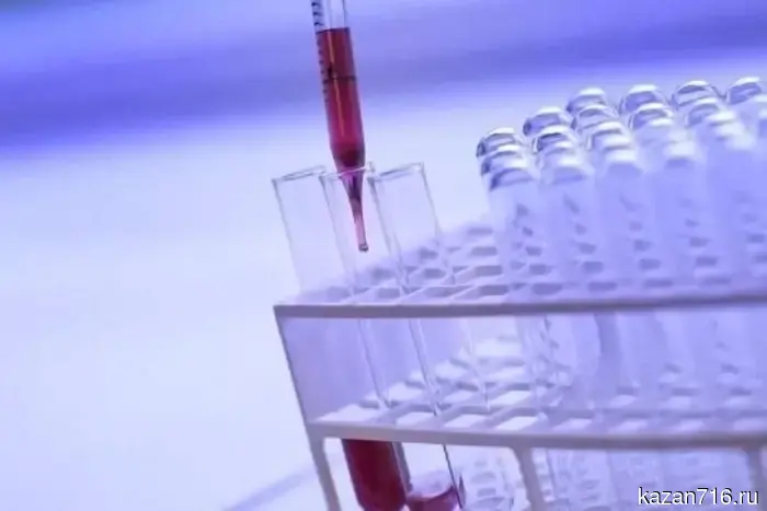 Для профилактики ВИЧ в Татарстане будет выделено 1,3 миллиона рублей.
